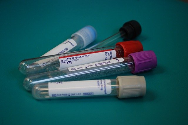 Test krvi može pomoći u ranom otkrivanju karcinoma